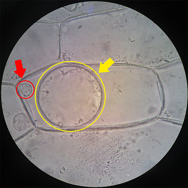 Plasmolysis - Biology - Science Forums